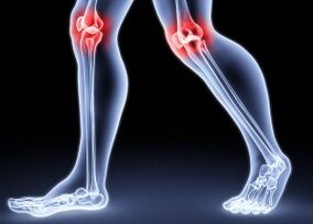 Causas de desarrollo articular de la rodilla