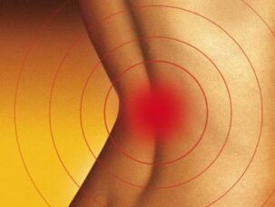 Dolor en la parte inferior con la osteocondrosis